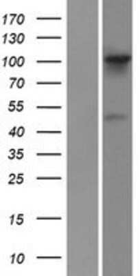 Western Blot: FGD1 Overexpression Lysate [NBP2-07871]