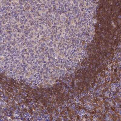 Immunohistochemistry: FGD2 Antibody [NBP2-48944]