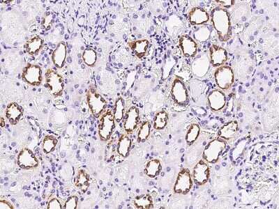 Immunohistochemistry-Paraffin: FGD2 Antibody [NBP2-99377]