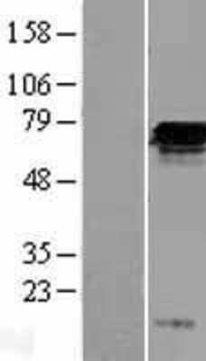 Western Blot: FGD2 Overexpression Lysate [NBL1-10685]