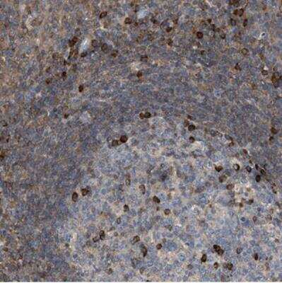 Immunohistochemistry: FGD3 Antibody [NBP2-30845]