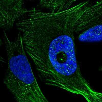 Immunocytochemistry/ Immunofluorescence: FGD4 Antibody [NBP1-85532]