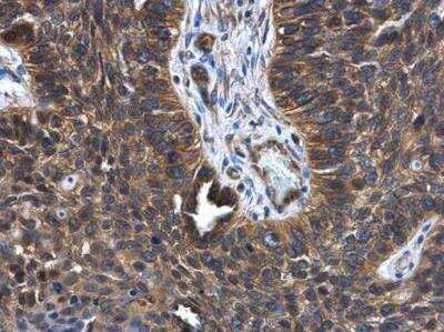 Immunohistochemistry-Paraffin: FGD4 Antibody [NBP1-31335]