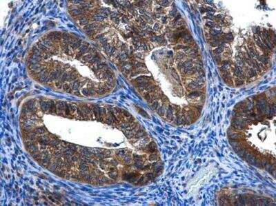Immunohistochemistry-Paraffin: FGD4 Antibody [NBP1-31335]