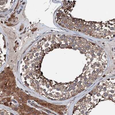 Immunohistochemistry-Paraffin: FGD4 Antibody [NBP1-85532]