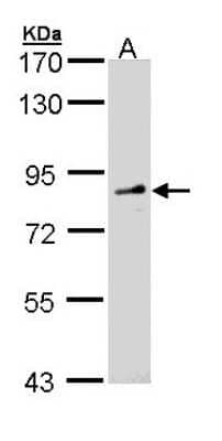 Western Blot: FGD4 Antibody [NBP1-31335]