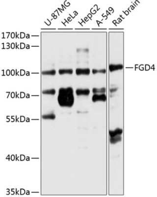 Western Blot: FGD4 AntibodyBSA Free [NBP3-05188]