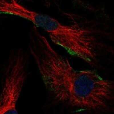 Immunocytochemistry/ Immunofluorescence: FGD5 Antibody [NBP3-17713]