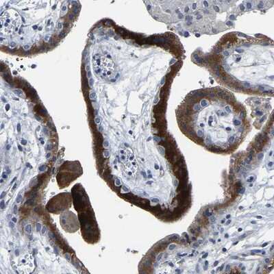 Immunohistochemistry-Paraffin: FGD5 Antibody [NBP1-83878]