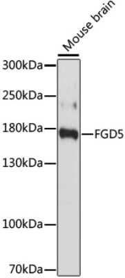 Western Blot: FGD5 AntibodyAzide and BSA Free [NBP3-04363]