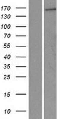 Western Blot: FGD5 Overexpression Lysate [NBP2-10241]