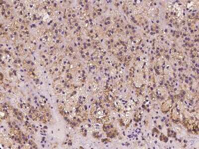 Immunohistochemistry-Paraffin: FGD6 Antibody [NBP2-98098]