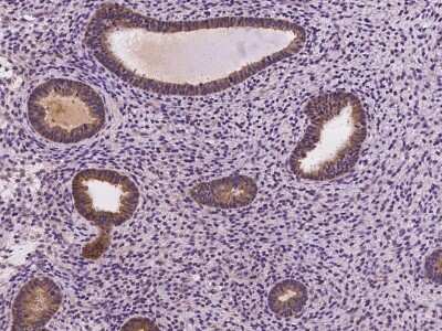 Immunohistochemistry-Paraffin: FGD6 Antibody [NBP2-98098]