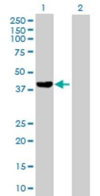 Western Blot: FGD6 Antibody [H00055785-B01P]