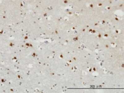Immunohistochemistry-Paraffin: FGF-12 Antibody (1D9) [H00002257-M10]
