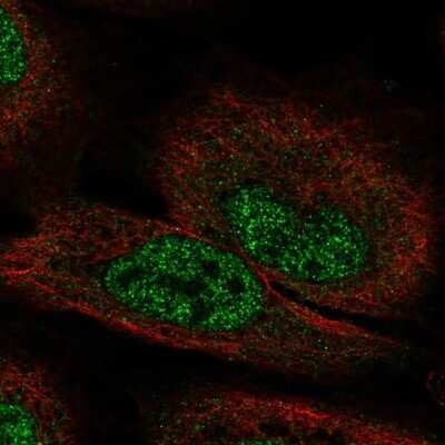 Immunocytochemistry/ Immunofluorescence: FGF-12 Antibody [NBP2-57305]