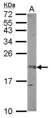 Western Blot: FGF-12 Antibody [NBP2-14956]