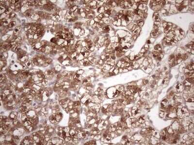 Immunohistochemistry: FGF-13 Antibody (OTI7E8) [NBP2-45642]
