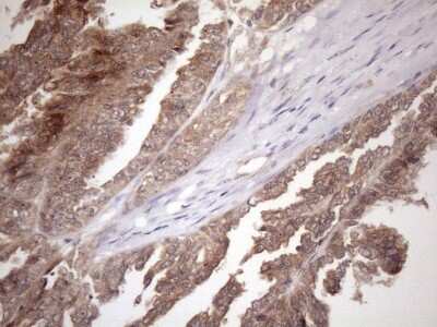 Immunohistochemistry: FGF-13 Antibody (OTI7E8) [NBP2-45642]