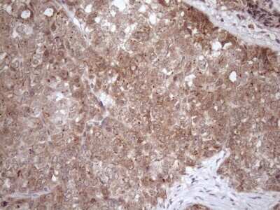 Immunohistochemistry: FGF-13 Antibody (OTI7E8) [NBP2-45642]