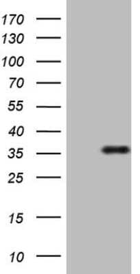 Western Blot: FGF-13 Antibody (OTI7E8) [NBP2-45642]