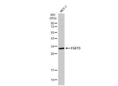 Western Blot: FGF-13 Antibody [NBP2-16471]