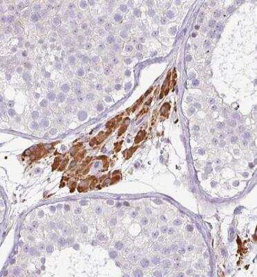 Immunohistochemistry: FGF-17 Antibody [NBP2-30401]