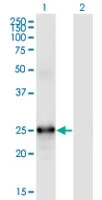 Western Blot: FGF-19 Antibody (4C4) [H00009965-M01]