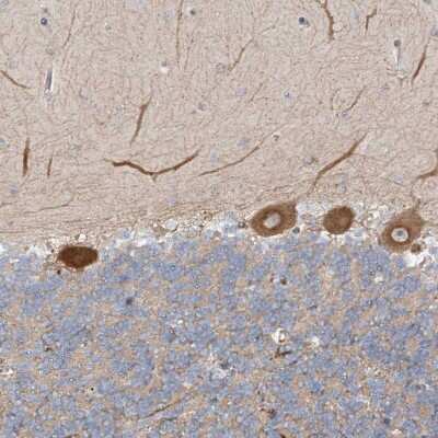 Immunohistochemistry-Paraffin: FGF-19 Antibody [NBP1-86294]