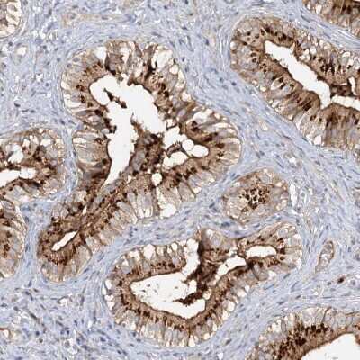 Immunohistochemistry-Paraffin: FGF-19 Antibody [NBP1-86294]