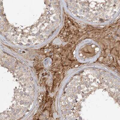 Immunohistochemistry-Paraffin: FGF-19 Antibody [NBP1-86294]