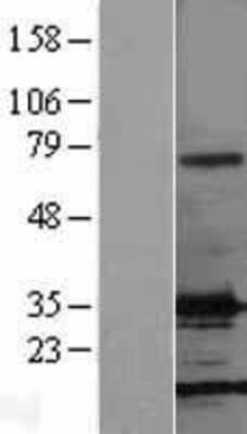 Western Blot: FGF basic/FGF2/bFGF Overexpression Lysate [NBL1-10694]