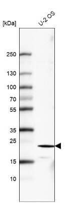 Western Blot: FGF-21 Antibody (CL6491) [NBP2-76496]