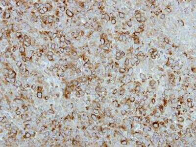Immunohistochemistry-Paraffin: FGF-21 Antibody [NBP1-31368]