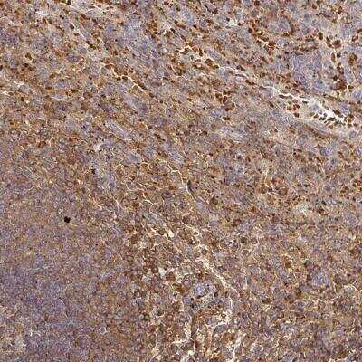 Immunohistochemistry-Paraffin: FGF-21 Antibody [NBP2-32347]