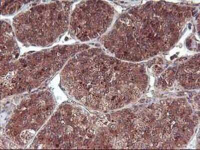 Immunohistochemistry: FGF-21 Antibody (OTI2F10) - Azide and BSA Free [NBP2-71815]