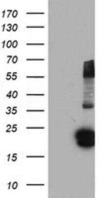 Western Blot: FGF-21 Antibody (OTI2F10)Azide and BSA Free [NBP2-71815]