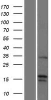 Western Blot: FGF-22 Overexpression Lysate [NBP2-06629]