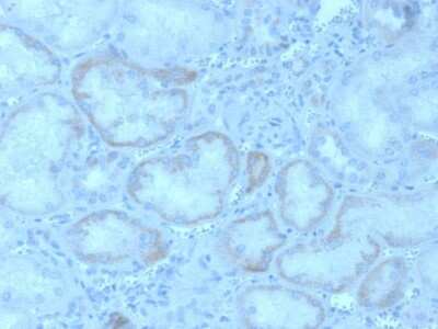 Immunohistochemistry-Paraffin: FGF-23 Antibody (FGF23/4162) - Azide and BSA Free [NBP3-08328]