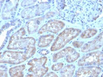 Immunohistochemistry-Paraffin: FGF-23 Antibody (FGF23/4162) - Azide and BSA Free [NBP3-08328]