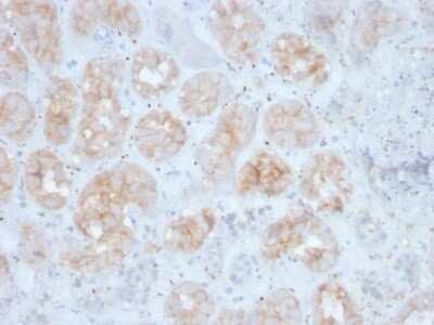Immunohistochemistry-Paraffin: FGF-23 Antibody (FGF23/4163) - Azide and BSA Free [NBP3-08329]
