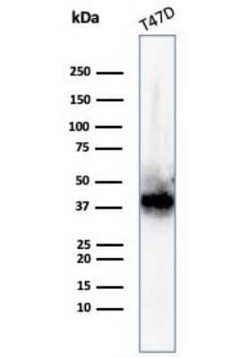 Western Blot: FGF-23 Antibody (FGF23/4163)Azide and BSA Free [NBP3-08329]