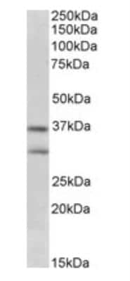 Western Blot: FGF-23 Antibody [NB100-55423]