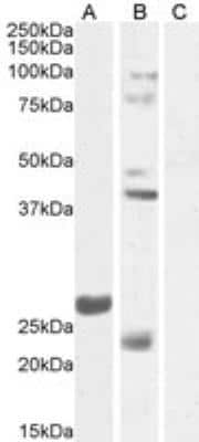 Western Blot: FGF-23 Antibody [NBP2-27553]