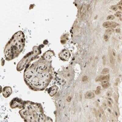 Immunohistochemistry-Paraffin: FGF-3 Antibody [NBP1-89718]