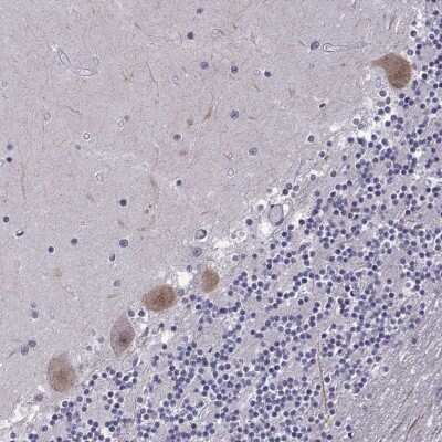 Immunohistochemistry-Paraffin: FGF-3 Antibody [NBP1-89718]