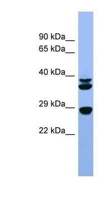 Western Blot: FGF-3 Antibody [NBP1-80503]