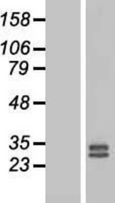 Western Blot: FGF-3 Overexpression Lysate [NBP2-10481]