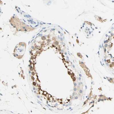 Immunohistochemistry-Paraffin: FGF-4 Antibody [NBP1-83291]