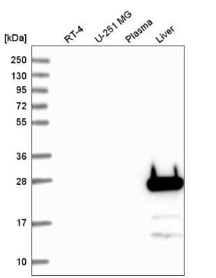 Western Blot: FGF-5 Antibody [NBP2-59013]